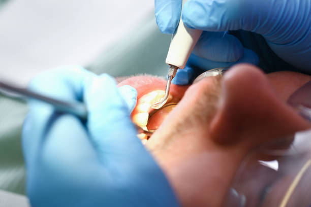 Best Emergency Dental Services for Seniors in Estill Springs, TN