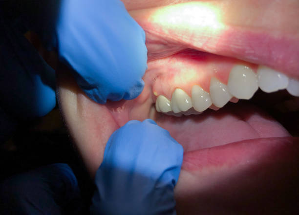 Best Urgent Dental Care for Toothache in Estill Springs, TN